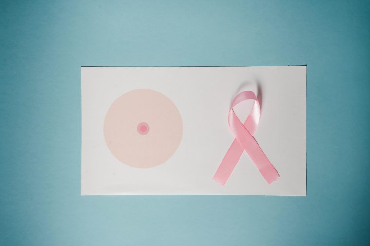 breast cancer