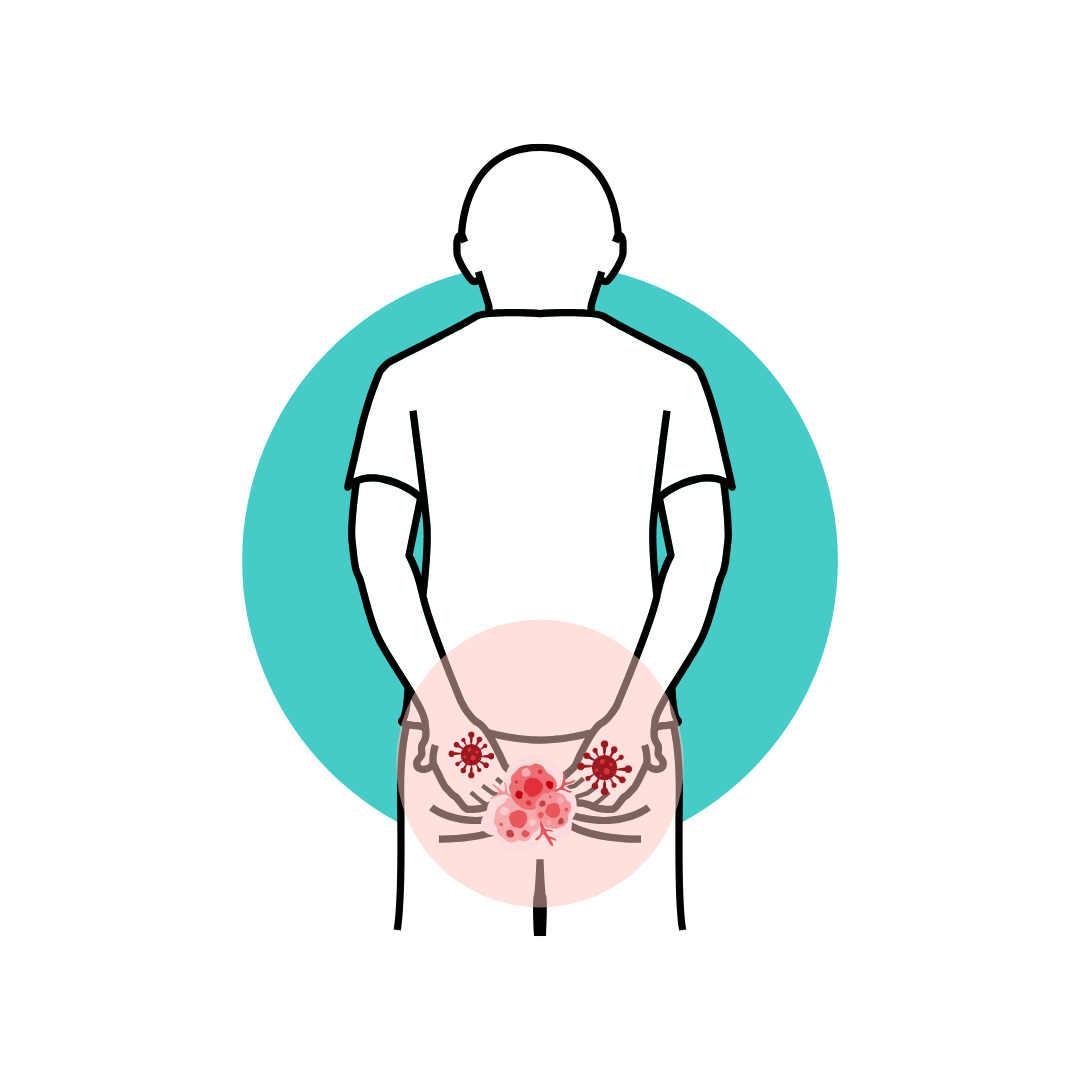 illustration of cancer