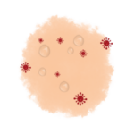 illustration of warts